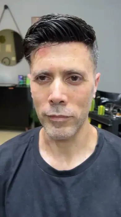Depois prótese capilar cliente 1
