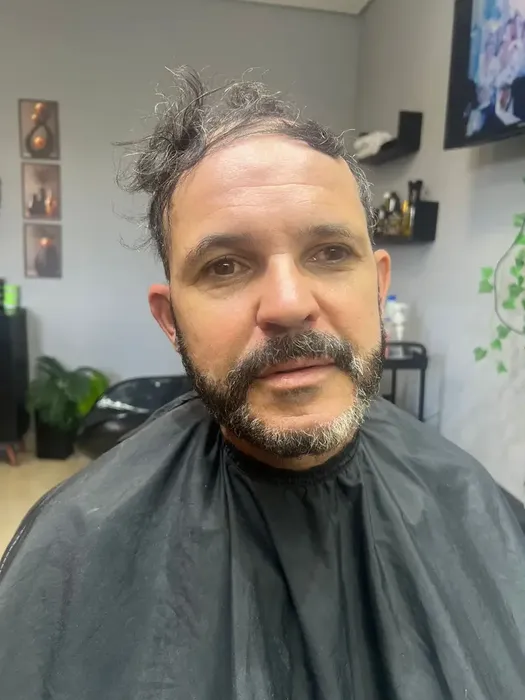 Antes prótese capilar cliente 2