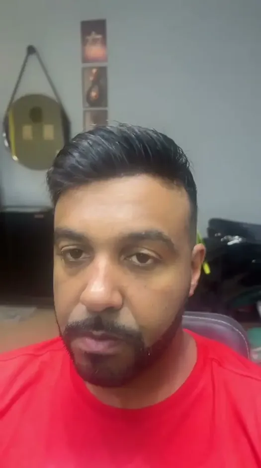 Depois prótese capilar cliente 3