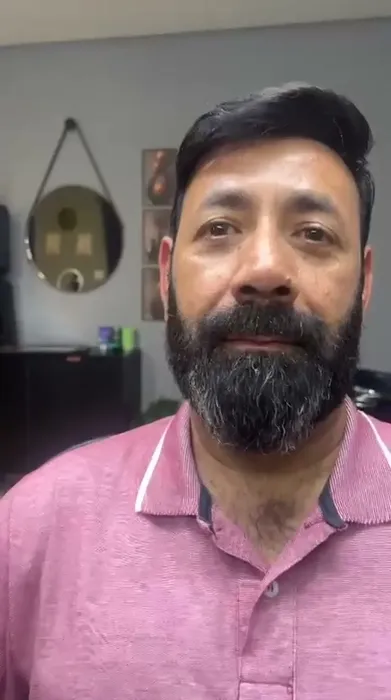 Depois prótese capilar cliente 6