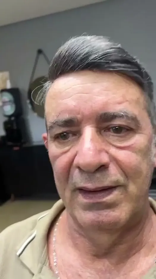 Depois prótese capilar cliente 8